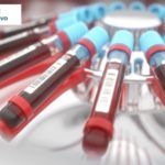 Synevo – badania laboratoryjne najwyższej jakości 2