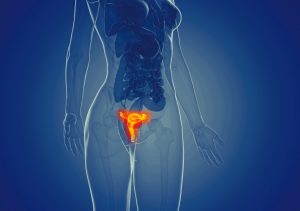 niedpłodność kobieca