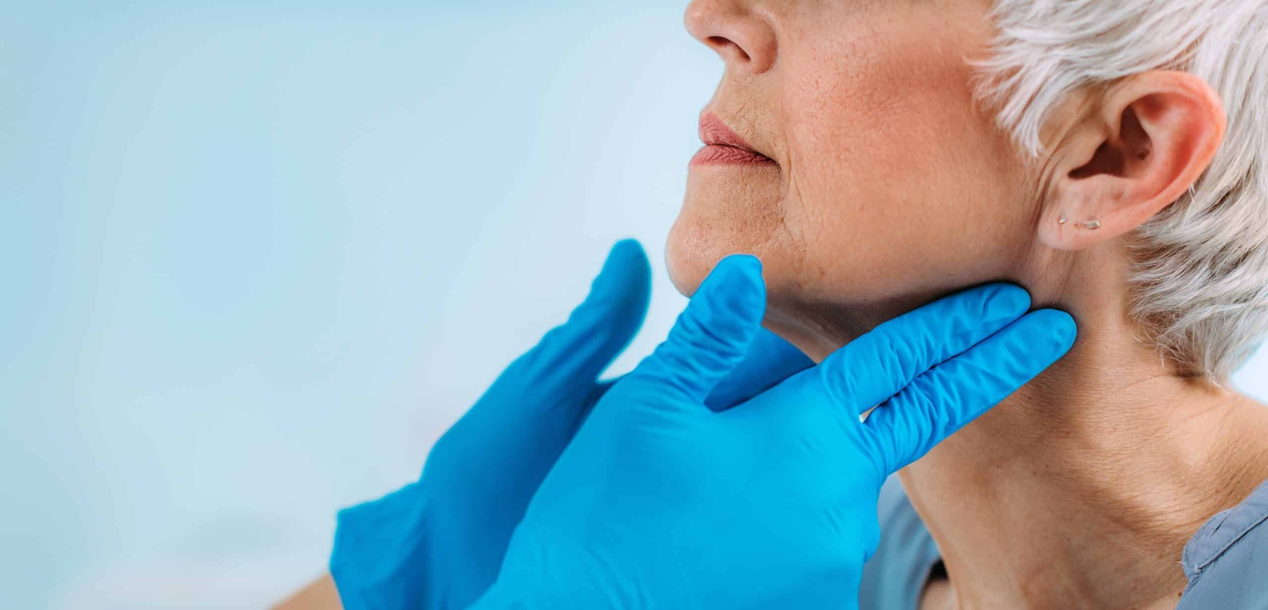 Nadczynność tarczycy