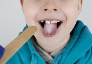 Blond boy has a white tongue. Painful white coating on the mucous membrane of the tongue. Diseases of the gastrointestinal tract, liver and gallbladder. The consequences of taking antibiotics.