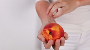 Pakiet badań - alergiczny owoce (10 alergenów)