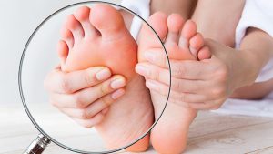 Ocena preparatu bezpośredniego oraz posiew w kierunku dermatofitów