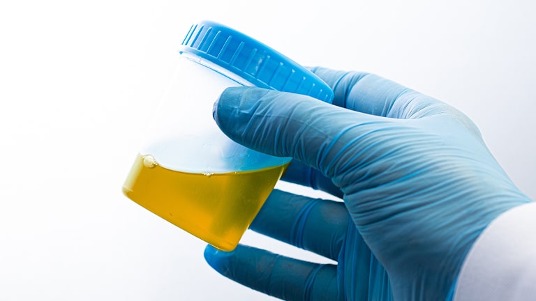 Badanie moczu w kierunku pasożytów tropikalnych badanie ogolne moczu